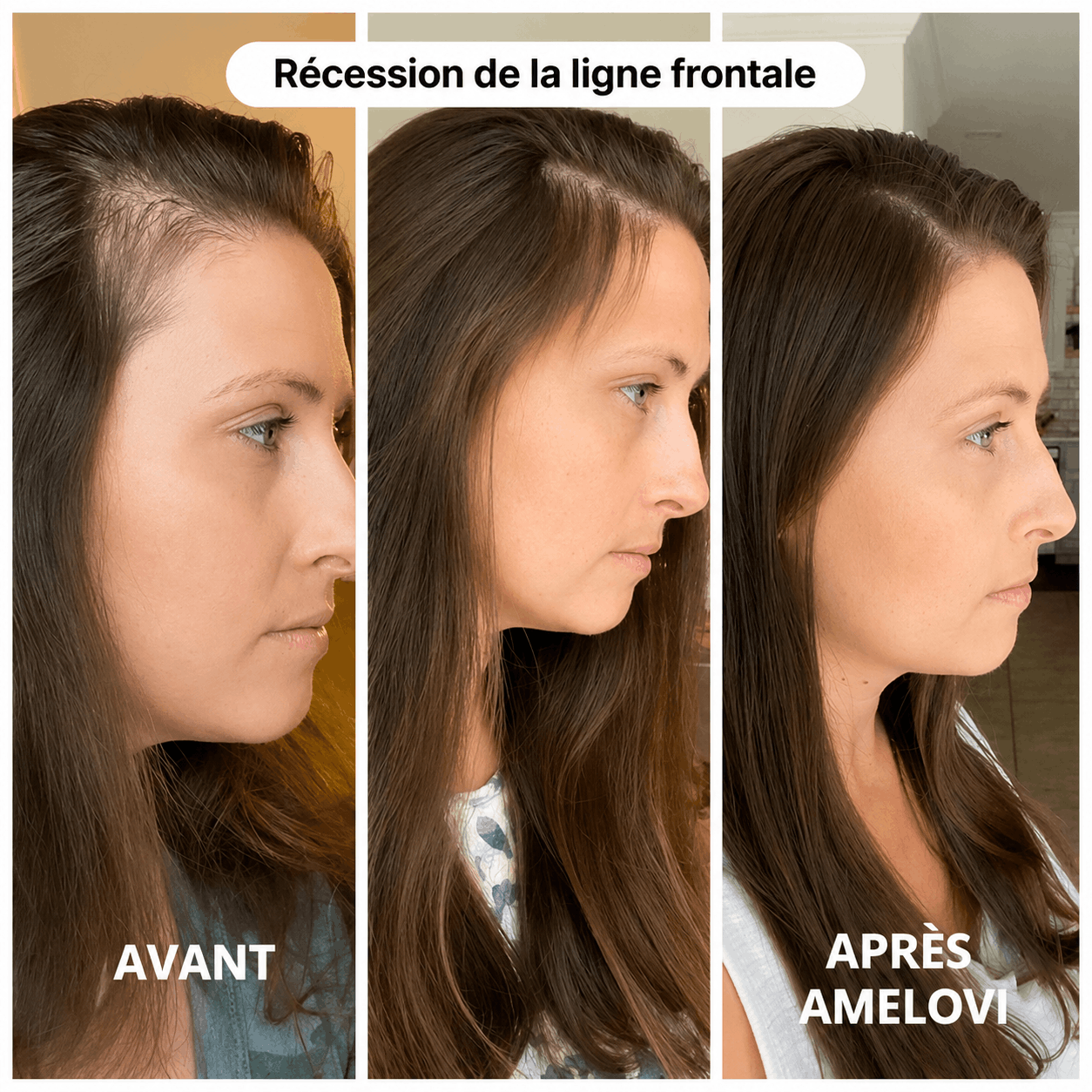 Amelovi – Shampoing Coréen Enrichi Pour la Croissance de Cheveux