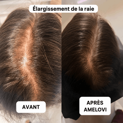 Amelovi – Shampoing Coréen Enrichi Pour la Croissance de Cheveux