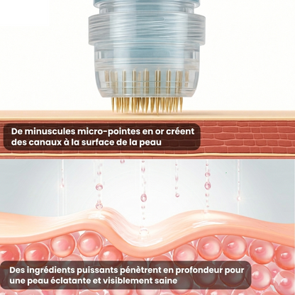 Amelovi® Micro-Infusion Pro™