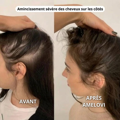 Amelovi – Shampoing Coréen Enrichi Pour la Croissance de Cheveux