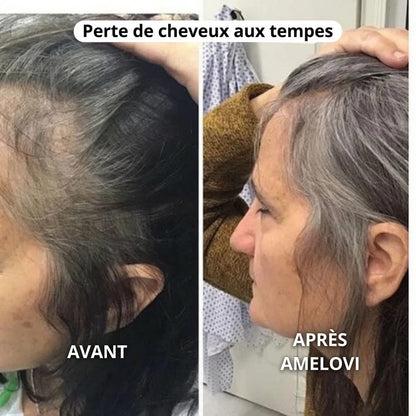 Amelovi – Shampoing Coréen Enrichi Pour la Croissance de Cheveux
