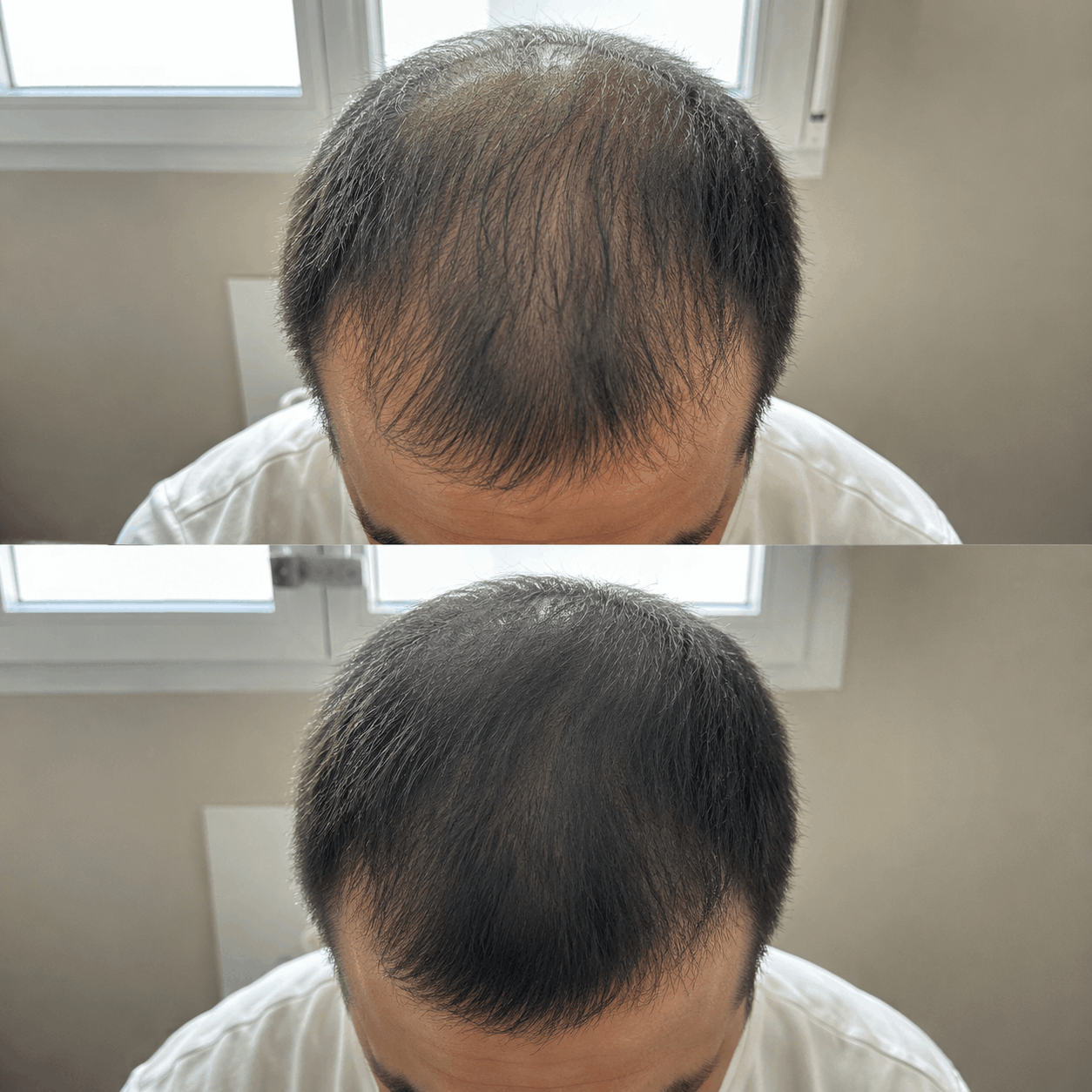 Amelovi – Shampoing Coréen Enrichi Pour la Croissance de Cheveux