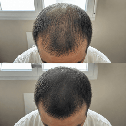 Amelovi – Shampoing Coréen Enrichi Pour la Croissance de Cheveux