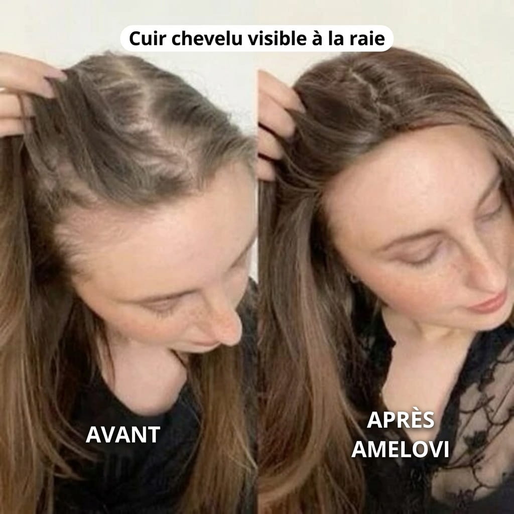 Amelovi – Shampoing Coréen Enrichi Pour la Croissance de Cheveux