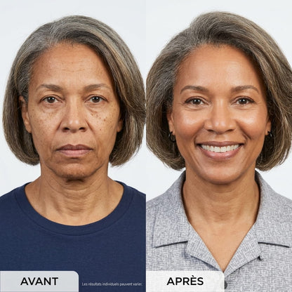 Amelovi® Micro-Infusion Pro™